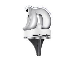 CE/FDA certified knee implant
